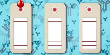 В MIT разработали очень простой и быстрый тест на иммунитет к COVID-19