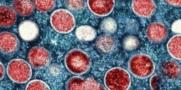ВОЗ объявила вспышку обезьяньей оспы чрезвычайной ситуацией мирового значения
