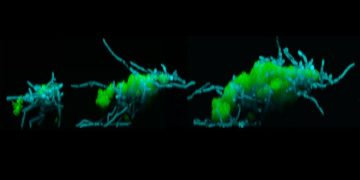 Вызывающий кариес суперорганизм научился перепрыгивать с зуба на зуб
