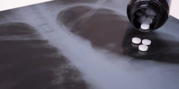 В США начались клинические испытания «таблеток от радиации»