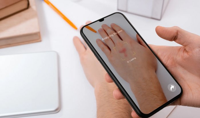 Google Lens теперь умеет определять проблемы с кожей 