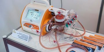 Российский прибор Life Stream Ecmo позволит оперативно восстановить кровообращение