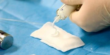 Российские ученые значительно улучшили состав «костного цемента»