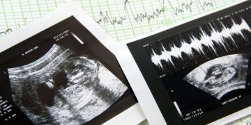 В РПЦ выступили за запрет абортов в частных клиниках