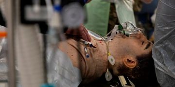 Минобороны Британии получило пугающе реалистичный манекен для обучения хирургов