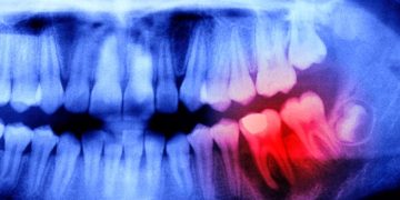 Японские ученые установили связь между здоровьем полости рта и мозга