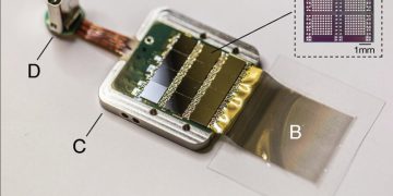 Священник прокомментировал историю с вживлением чипа в мозг человека