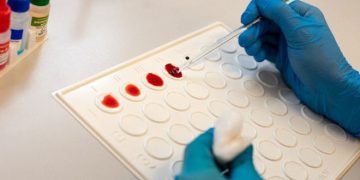 В России смогут определять сепсис всего за одни сутки