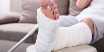 Пьезоэлектрический «костный бандаж» значительно ускоряет срастание костей