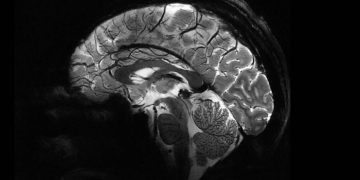 Новый МРТ-аппарат Iseult в несколько раз превосходит возможности конкурентов