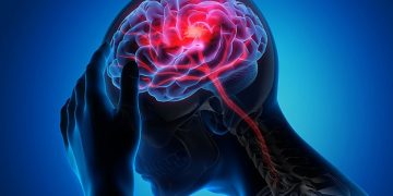 Стремительные изменения климата резко увеличили количество инсультов