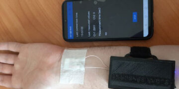 В Новосибирске создают неинвазивный сенсор, определяющий уровень глюкозы