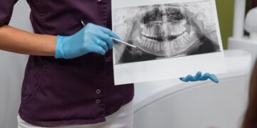 Компьютерная томография зубов: что это и как она работает?